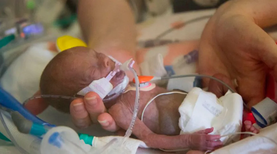 VIDEO: Les dijeron que no viviría. Bebé milagro se libró del aborto y desafió a la ciencia