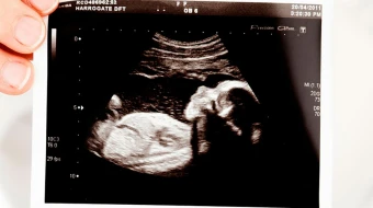 Imagen referencial. Créditos: Pixabay