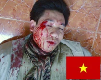 Hermano redentorista Anthony Nguyen Van Tang, luego del ataque