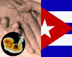 Cuba: Aborto sin control es una de las causas del envejecimiento poblacional