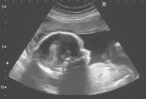 Imagen referencial. Foto: Richard Mansfield (CC BY-NC-ND 2.0)