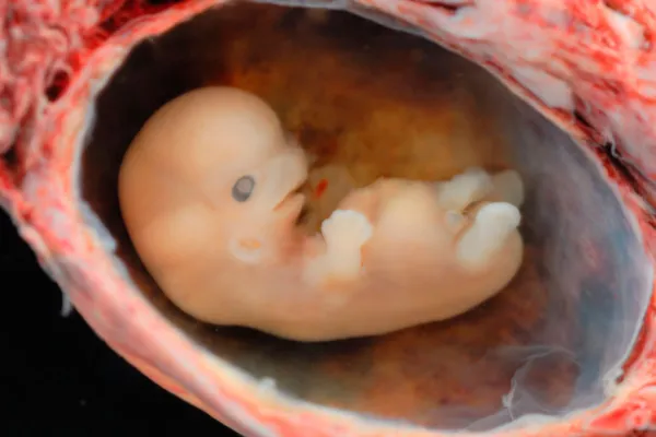 Embrión de 6 a 7 semanas. Foto: Steven O'Connor, M.D., Houston Texas.