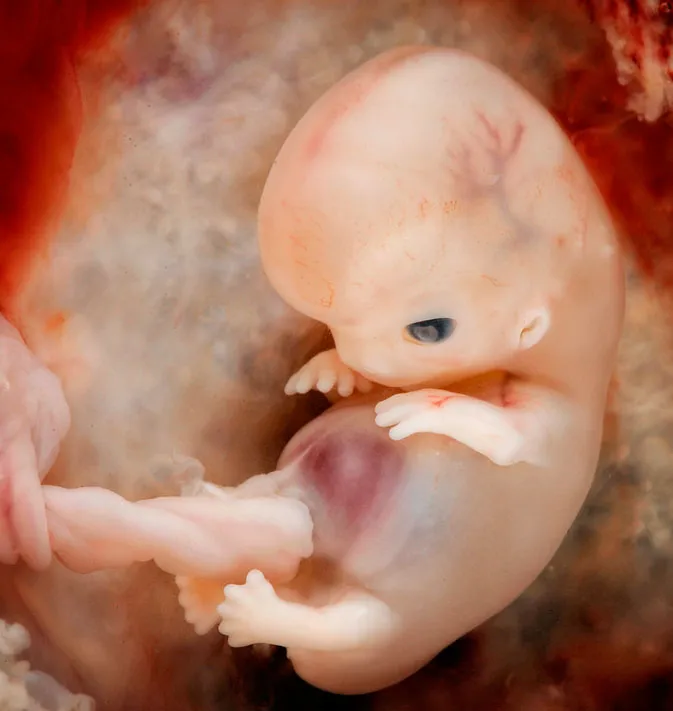 Embrión de 7 a 8 semanas. Foto: Steven O'Connor, M.D., Houston Texas.