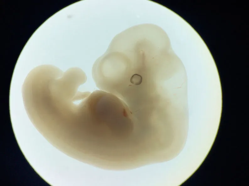 Embrión de 7 semanas. Foto: Steven O'Connor, M.D., Houston Texas.