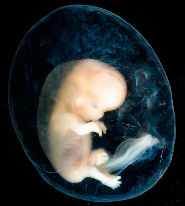 Embrión de 8 a 10 semanas. Foto: Steven O'Connor, M.D., Houston Texas.