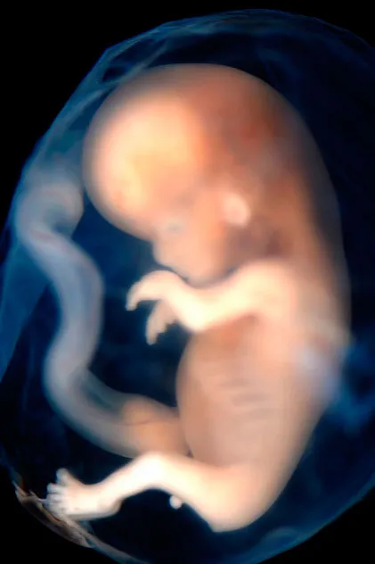 Embrión de 9 a 10 semanas. Foto: Steven O'Connor, M.D., Houston Texas.