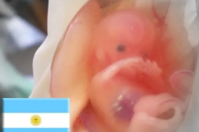 Piden a médicos argentinos negarse a practicar abortos