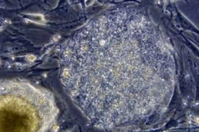 Científicos convierten células de la piel en músculo cardíaco