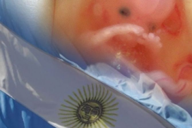 Argentina: Resistencia pro-vida evita aplicación de aborto por violación