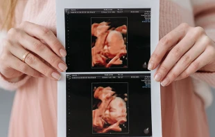 Imagen referencial. Cru00e9dito: Foto de Pavel Danilyuk / Pexels 