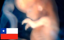 Imagen referencial. Foto: Lunar Caustic (CC BY-SA 2.0)