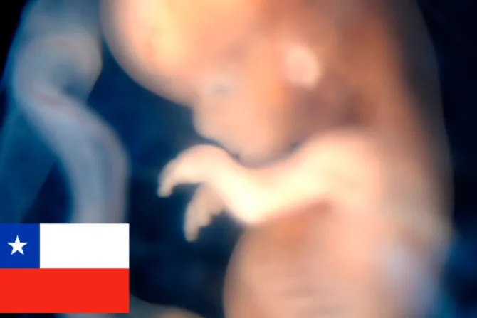 “El aborto no es una política pública, es una ideología”, aclara médico ante debate en Chile