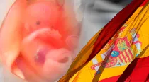 Aborto España / Foto: Suparna Sinha - GiladRom (CC-BY-SA-2.0)-(CC-BY-SA-3.0)