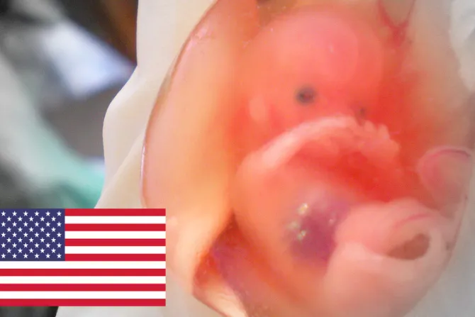 Estados Unidos: Proyecto de ley abortista anularía toda ley pro-vida en Colorado