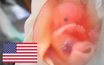 Imagen referencial. Foto: Suparna Sinha (CC-BY-SA-2.0)