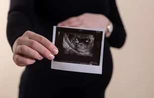 Imagen referencial. Cru00e9dito: Foto de Volodymyr Hryshchenko en Unsplash 