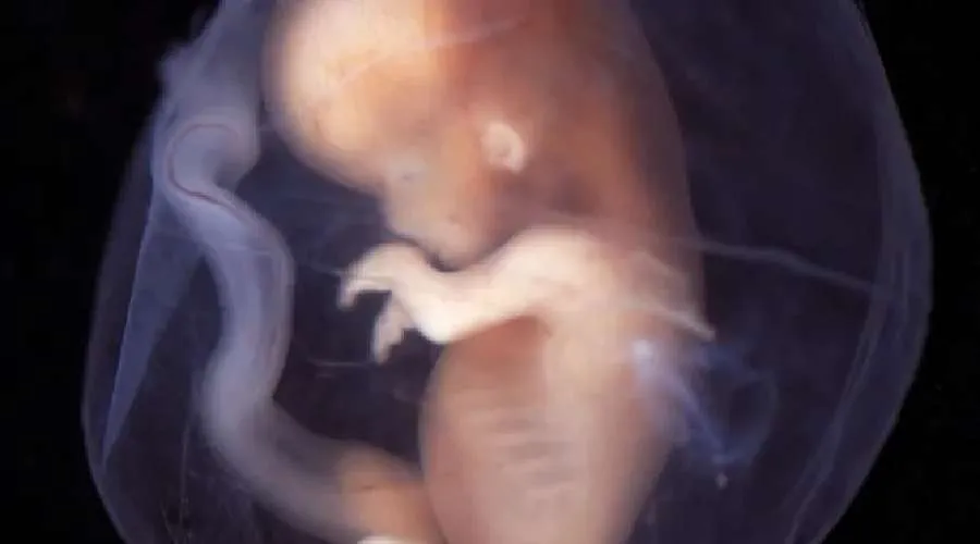 The Guardian se equivoca: Así se ve un bebé de nueve semanas en el vientre