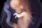 The Guardian se equivoca: Así se ve un bebé de nueve semanas en el vientre