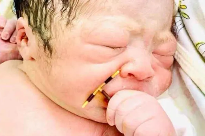 VIRAL: Bebé con DIU en la mano es un triunfo de la vida, dice experta