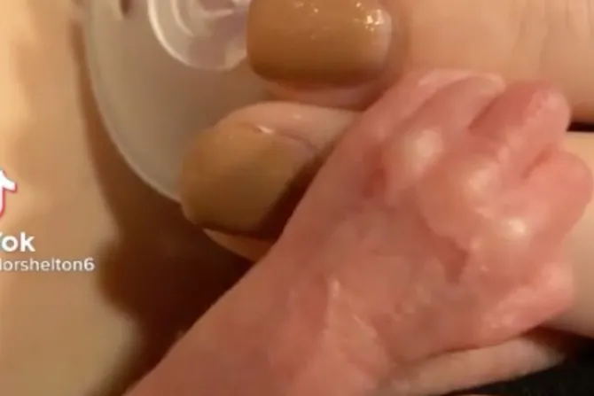 Video de bebé prematura estrechando la mano de su madre conmueve las redes