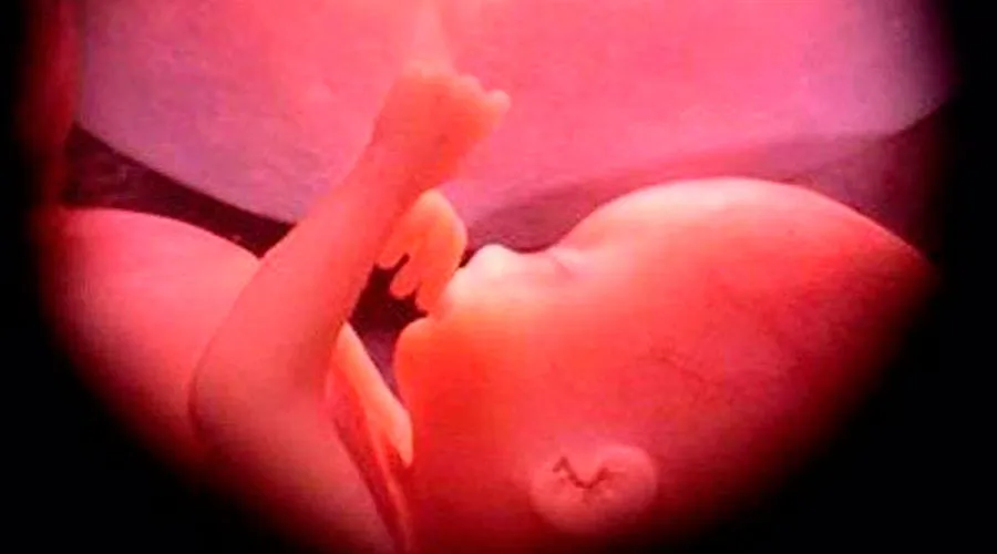 Niña de 10 años es sometida a aborto en Brasil