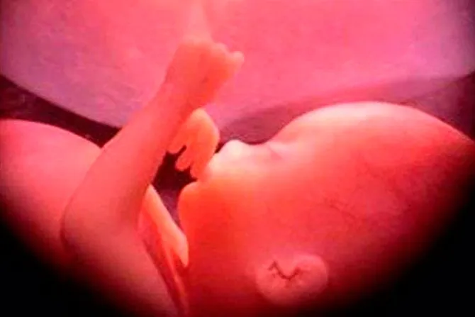 Niña de 10 años es sometida a aborto en Brasil