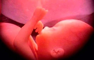 Imagen referencial. Cru00e9dito: Ivon19 CC-BY-SA-4.0 