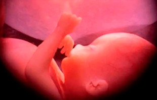 Imagen referencial. Cru00e9dito: Ivon19 / Wikipedia (dominio pu00fablico) (CC-BY-SA-4.0). 