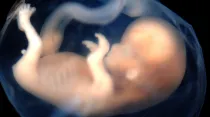 Embrión de 9 - 10 Semanas de Gestación. Foto: Lunar Caustic (CC BY-SA 2.0)