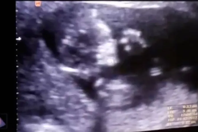 Este bebé aplaudiendo en el vientre de su madre es lo más tierno que verás hoy [VIDEO]