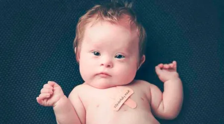 Este bebé con síndrome de Down sanó por intercesión de fundador de los Caballeros de Colón