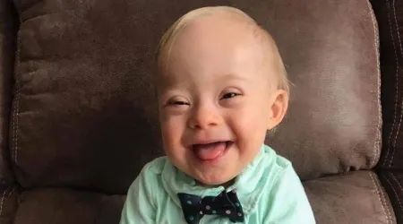 Por primera vez Gerber usa como imagen a bebé con síndrome de Down
