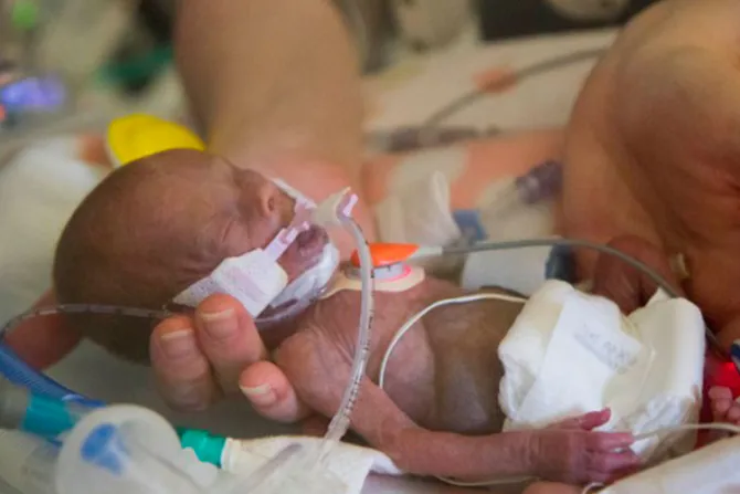 VIDEO: Les dijeron que no viviría. Bebé milagro se libró del aborto y desafió a la ciencia
