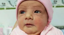 Lía María Isabel, la primera bebé en Paraguay que fue sometida a una cirugía en el vientre materno para corregir una malformación vertebral / Cortesía de FetoSur 