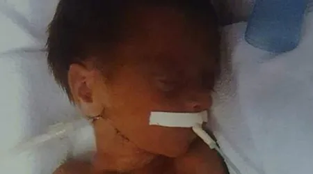 Médicos dijeron que esta bebé prematura no sobreviviría: La oración la salvó