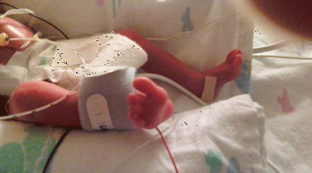 Riley naciu00f3 en un parto prematuro pero para la ley era un aborto y lo dejaron morir