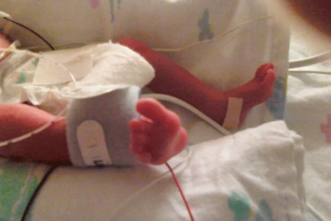 Riley nació en un parto prematuro pero para la ley era un aborto y lo dejaron morir