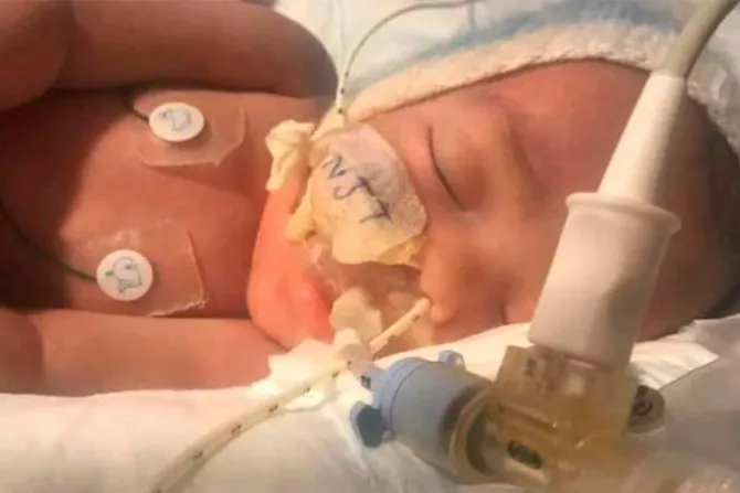 Desconectan respirador de bebé tras controversial decisión médica en Reino Unido