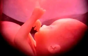 Imagen referencial. Cru00e9dito: Ivon19 (Wikipedia - CC-BY-SA-4.0). 