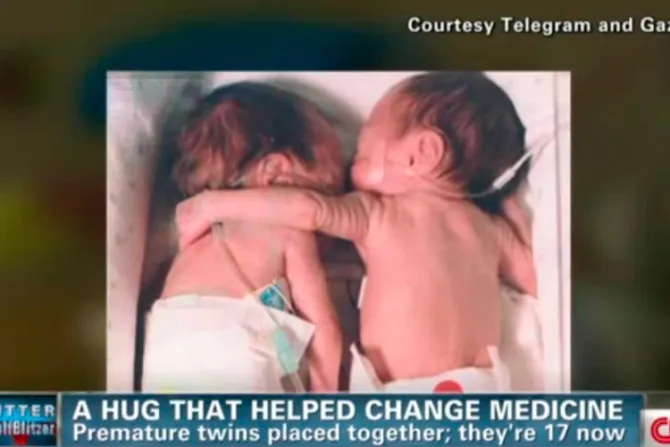 [VIDEO] El “abrazo del rescate” de dos bebés prematuras que cambió la medicina