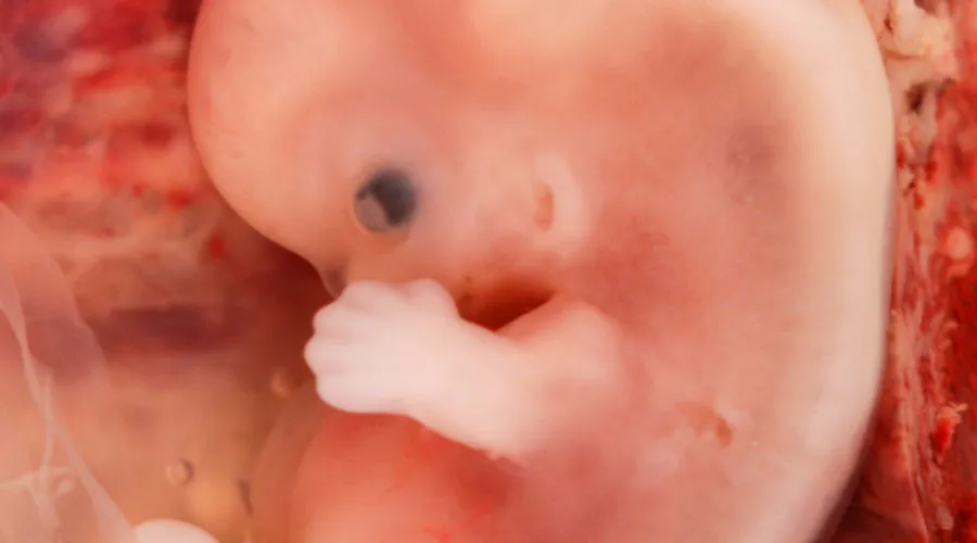 Embrión humano de 9 semanas / Crédito: Ed Uthman - Wikimedia Commons (CC BY 2.0)