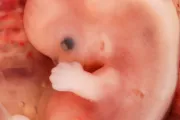 Juez bloquea ley que prohíbe abortos al detectarse latidos del corazón del feto