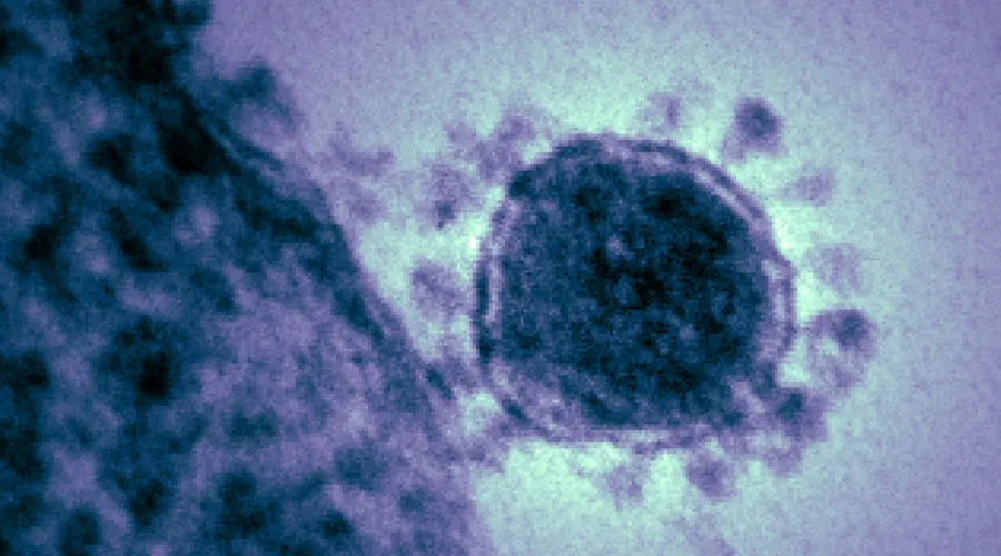 Coronavirus. National Institute of Health / Dominio público?w=200&h=150