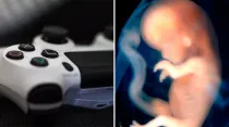 Imagen referencial (izquierda) - Crédito: Unsplash / Embrión de 9 a 10 semanas (derecha) - Crédito: Steven O'Connor, M.D., Houston Texas.