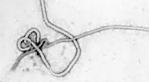 Virus del Ébola. Foto: Wikipedia / Dominio Público
