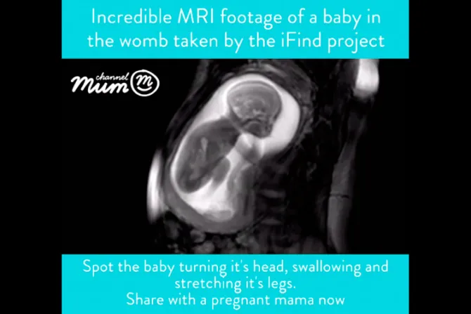 VIDEO: Nueva tecnología permite imágenes increíbles de bebé en gestación 