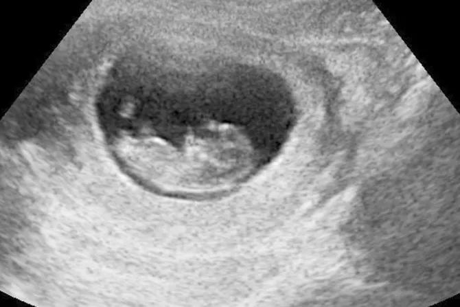 Aprueban ley que prohíbe aborto cuando se detectan latidos del corazón del feto