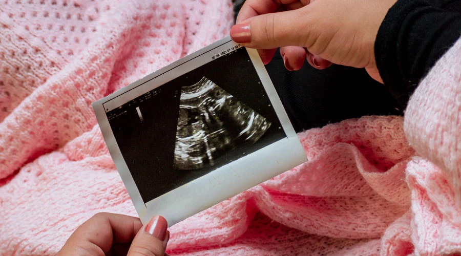 Una madre sostiene una fotografía del ultrasonido de su bebé por nacer. Crédito: Unsplash?w=200&h=150