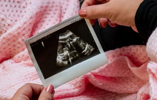 Una madre sostiene una fotografu00eda del ultrasonido de su bebu00e9 por nacer. Cru00e9dito: Unsplash 