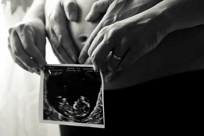 Objeción de conciencia: Derecho legítimo cuando el aborto es legal